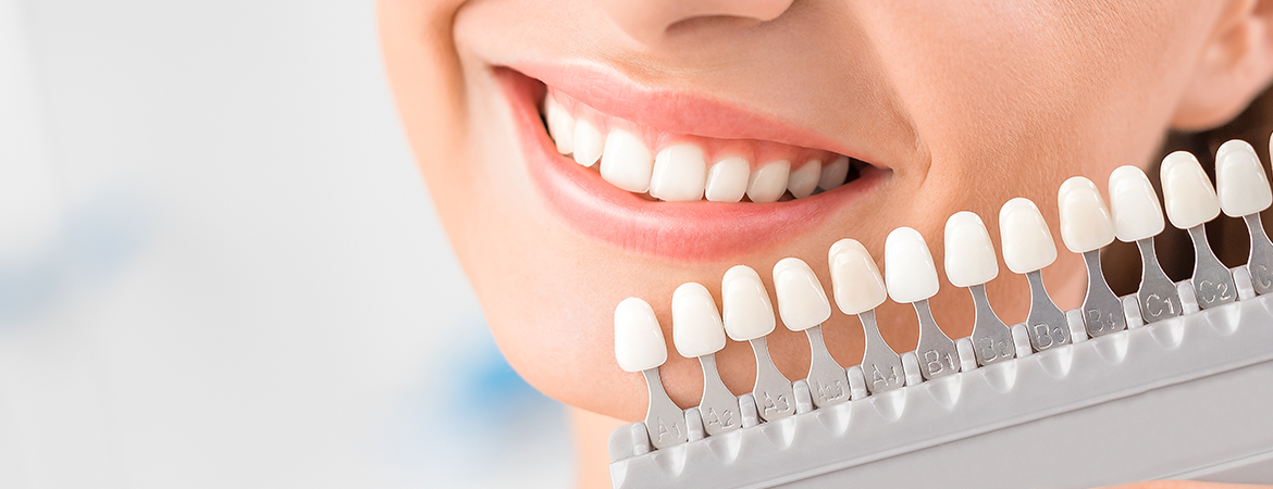 Dental Clinics in Singapore for Teeth Whitening - Banner